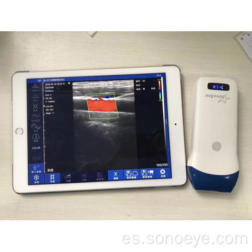 Dispositivos de ultrasonido de mano inalámbrico
